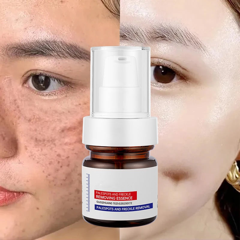⚡5-second brightening！Vitamin C Whitening Freckles ESSENCE